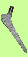 Титановая ножка Цваймюллера